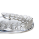 Started the teeth alignment (orthodontic treatment)